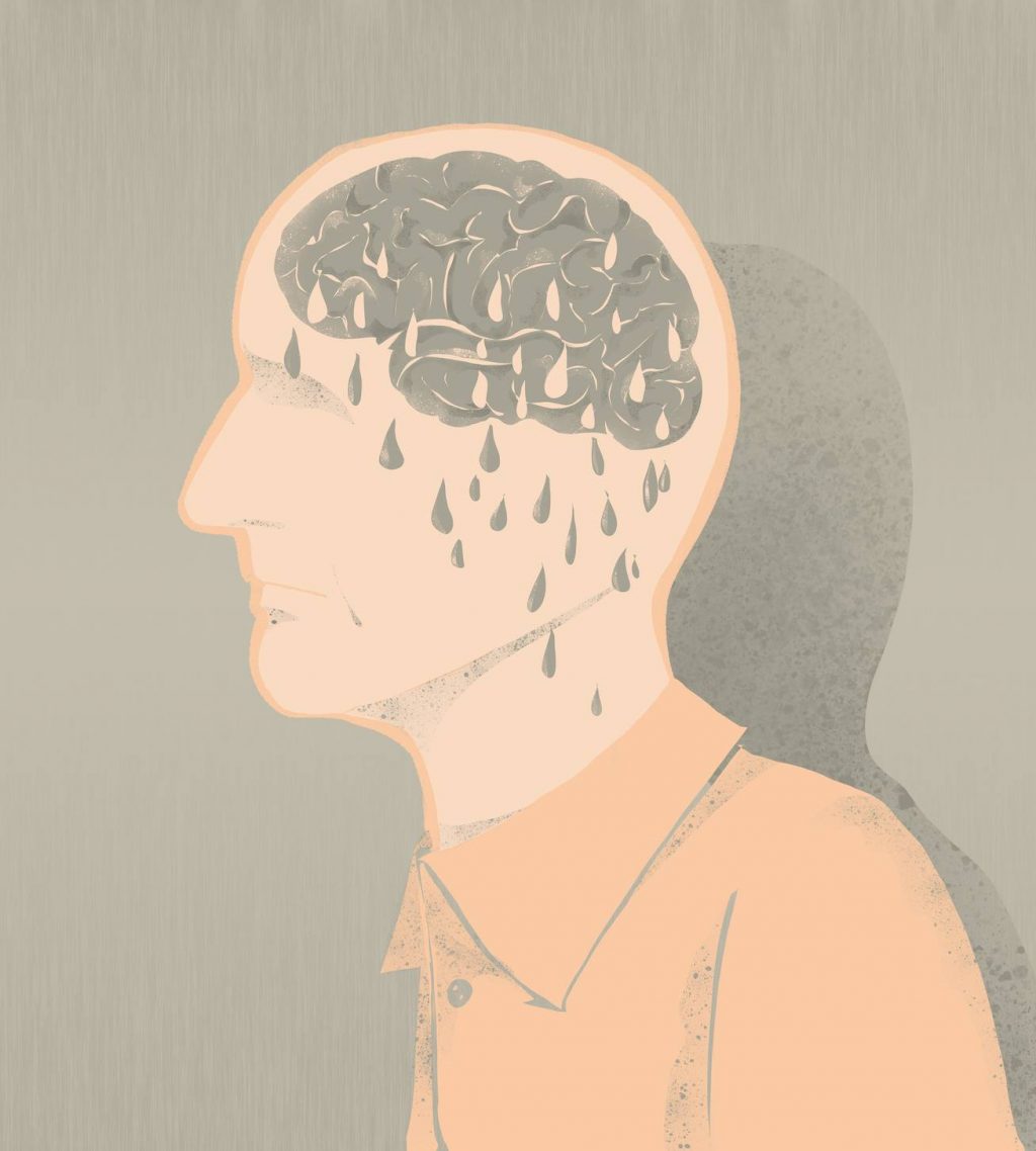 Alzheimer