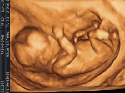 Dowiedziałaś się, że jesteś w ciąży? – Czas na pierwszą wizytę u ginekologa.